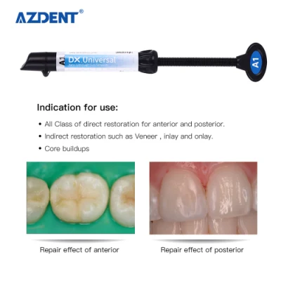 Resina compuesta híbrida fotopolimerizable universal dental Tono A1, A2, A3, A3.5, B1, B2